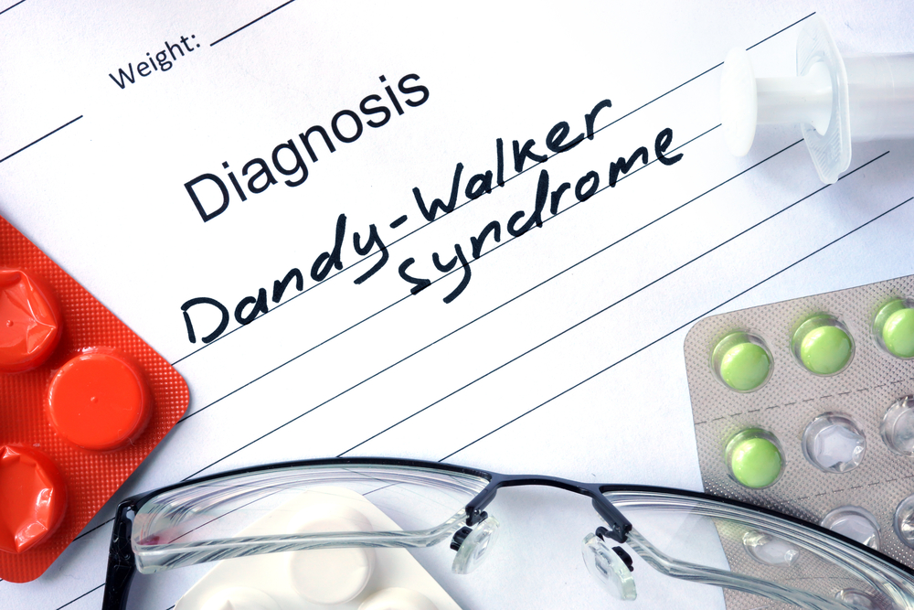 shutterstock 287769215 - Dandy Walker Syndrom: Ursachen, Symptome und Behandlungsmöglichkeiten